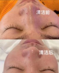 -芳朵美容养生SPA