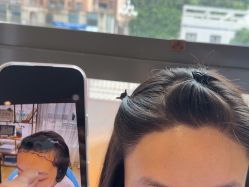 -碧莲盛·不剃发植发