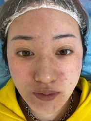 体验前-西安壹加壹医疗美容·西北抗衰旗舰店