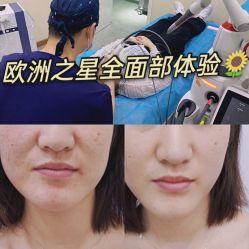 点击看大图 体验前-和颜一美轻医美连锁