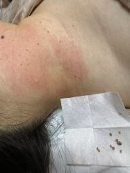 -清疣美疣·痣·斑净肤中心