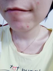 -痘院士专业祛痘皮肤管理