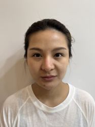 体验前-Yestar 嘉兴艺星医疗美容医院