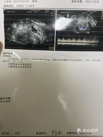 关于药流后24天的心得
