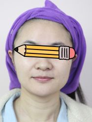 点击看大图 -广州美莱医疗美容医院
