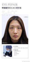 -丰联丽格医疗美容·联合丽格眼整形中心