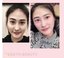 点击看大图 -深圳阳光医疗美容医院·旗舰店