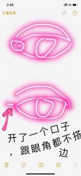 体验后-天津健丽·去眼袋医疗美容机构