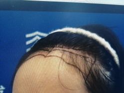 -雍禾植发全国连锁