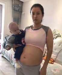 -Lily纤美·科技减脂中心