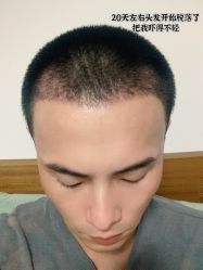 -雍禾植发全国连锁