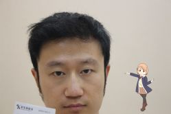 -大麦微针植发丨全国连锁