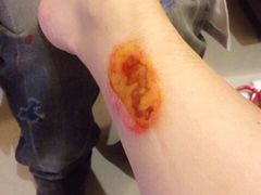 iphone_upload_pic-莱蔻·圣灸堂·推拿艾灸(天山店)