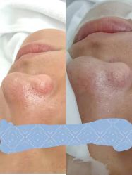 -SKIN79皮肤管理中心