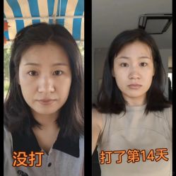 -上海伊莱美医疗美容医院
