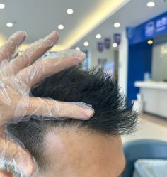 -大麦微针植发全国连锁