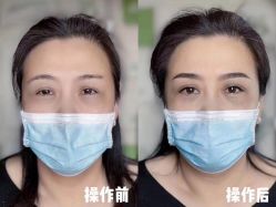 -西施无菌半永久纹绣眉眼影唇轻增发纹发际线