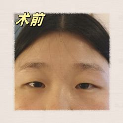 -素美医疗美容·西南眼鼻整形·修复基地
