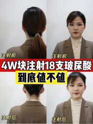 -Yestar宁波艺星整形医院