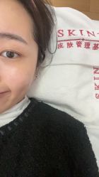 -skin79皮肤管理基站