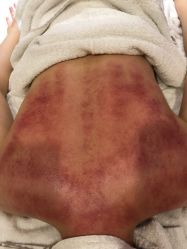 点击看大图 -苑苑vbeauty科技美容SPA