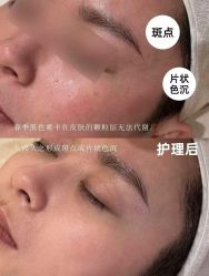 -克丽缇娜
