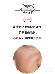 -凡碧诗毛孔清洁收细
