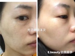-E.beauty驻颜·痘敏肌调理中心