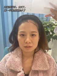 -雍禾植发全国连锁