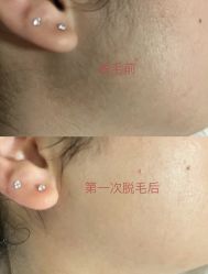 -中科妍美专业脱毛美肤连锁机构