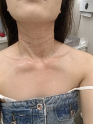 -佛山曙光金子医学美容医院