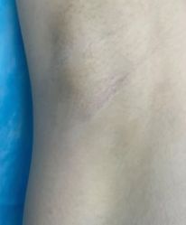 -薇兰专业脱毛连锁机构