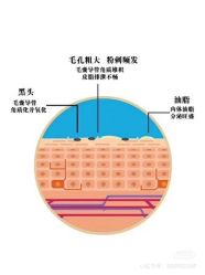 -凡碧诗毛孔清洁收细