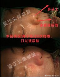 -北京米扬丽格医疗美容·联合丽格鼻整形中心
