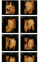 -郑州万安妇产医院