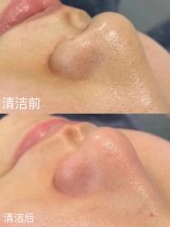 -宥莉·ULLY 痘敏肌•科技皮肤管理中心