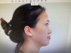-宁波壹加壹口腔·矫正种植中心