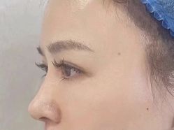 -杭州米兰柏羽医疗美容医院