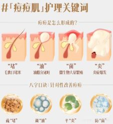 -克丽缇娜