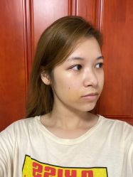 -杭州奥拉克医疗美容门诊部