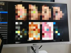 -苑苑vbeauty科技美容SPA
