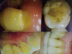 -Dr.Z dental仁康种植矫正中心