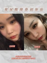 -Yestar宁波艺星整形医院