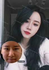 -北京米扬丽格医疗美容·联合丽格鼻整形中心