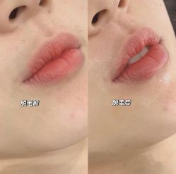-MUSES专业脱毛比基尼サロン日式连锁