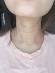 -小忠丽格医美