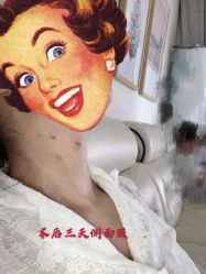 -大麦微针植发全国连锁