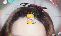 -大麦微针植发全国连锁