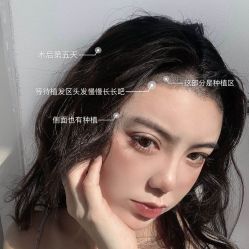 -碧莲盛·不剃发植发