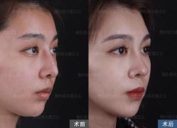 -北京米扬丽格医疗美容·联合丽格鼻整形中心